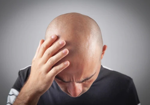 3 mitos sobre a calvície e por que ela não é 'necessariamente ruim', segundo especialista ( Imagem: Freepik)