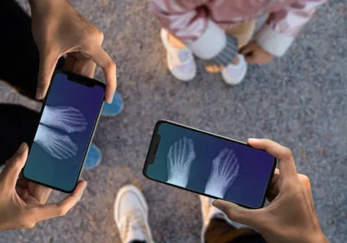 Confira os melhores aplicativos para fazer raio x