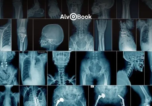 Aplicativo de raio-X pelo celular gratuito