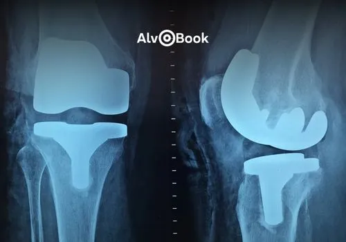 Aplicativo para simular raio-x no celular