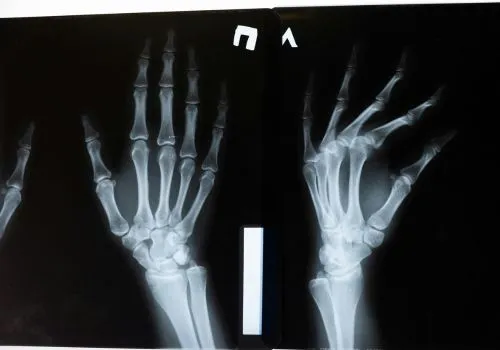 Aplicativos de raio-x pelo celular