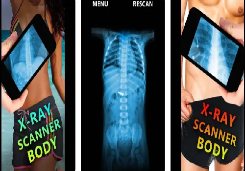 Reprodução Aplicativo X-Ray Scanner Body